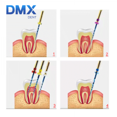 DMXDENT Dental Root Canal NiTi Endo Files Rotary PT-Blue Taper Root Canal 21/ 25MM